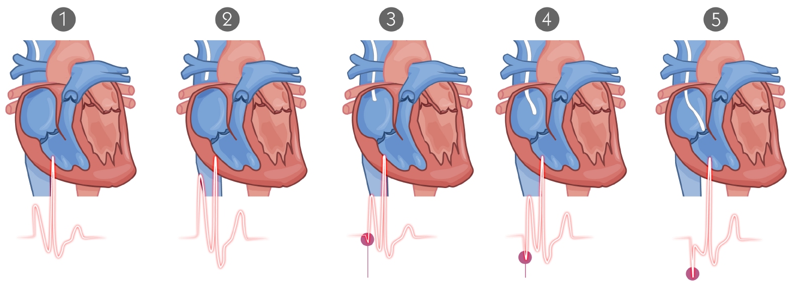 FAQ Cateteri PICC e Midline