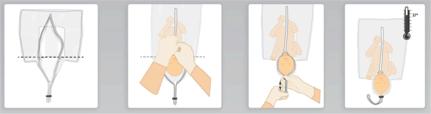 Vygon Neohelp Heat Loss Bag – Medsales