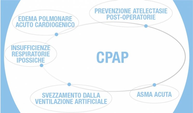 FAQ CPAP di Boussignac
