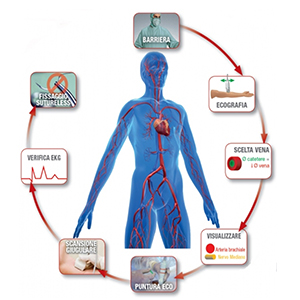 FAQ Cateteri PICC e Midline